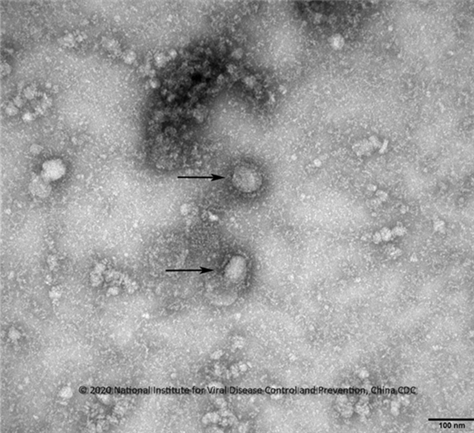 ▲ 이번 중국 폐렴의 원인은 신종 코로나바이러스로 밝혀졌다. 우한 코로나바이러스 전자현미경 사진.