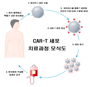 ▲   서울대병원은 8일, ‘소아청소년 급성림프모구백혈병 대상 CAR-T 치료 임상연구’를 승인받았다. 