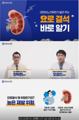 ▲ 대한비뇨의학회은 요로결석에 대해 일반인들이 알아야 할 정보를 담은 ‘요로결석 바로알기’ 동영상을 학회 유튜브 채널에 공개한다고 밝혔다.