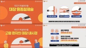 ▲ 대한소화기내시경학회와 대한장연구학회는 대장암 조기 발견 및 예방을 위한 ‘장(腸)주행 캠페인’의 일환으로 대장 용종 절제술 및 대장 내시경 검사 시 고령 인구가 알아야 할 정보를 제공하는 두 개의 영상을 대한소화기내시경학회 유튜브 채널에 공개한다고 밝혔다.