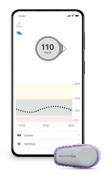 ▲ 연속혈당측정기(Continuous Glucose Monitoring, CGM)가 인슐린이 필요하지 않은 제2형 당뇨병 환자에서도 상당한 임상적 이득을 제공한다는 연구 결과가 발표됐다. 사진은 연구에 활용한 연속혈당측정기 덱스콤 G6.