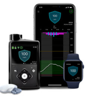 자동 인슐린 주입 기기(Automated Insulin Delivery, AID)가 제1형 당뇨병 환자의 혈당 조절에 보다 효과적이라는 연구 결과가 발표됐다. 사진은 메드트로닉의 AID 미니메드780G