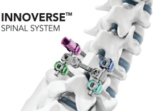 ▲ 시지메드텍은 자사의 척추 고정 장치 ‘이노버스 스파이널 시스템(INNOVERSE Spinal System)’이 미국 식품의약국(FDA) 승인을 획득한 데 이어, 최근 미국 병원에서 첫 수술에 성공적으로 적용됐다고 밝혔다.