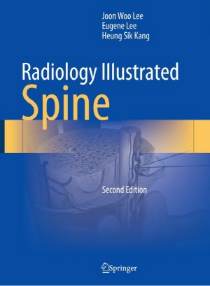 ▲ 분당서울대병원 영상의학과 이준우ㆍ이영준 교수가 ‘스프링거(Springer)’에 ‘Radiology Illustrated: Spine’ 2판을 출판했다. 